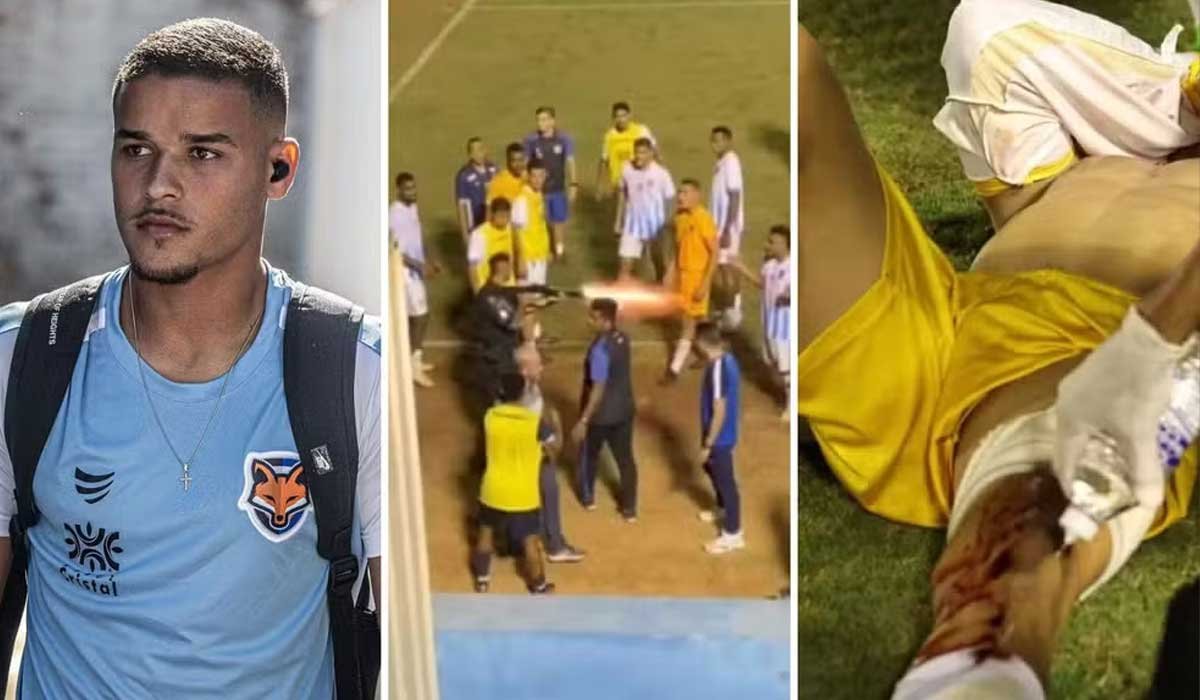 PM afasta policial filmado dando tiro de bala de borracha em goleiro após jogo