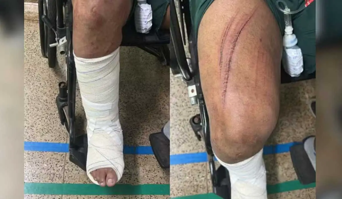 Garoto de programa pula do 2º andar para fugir de clientes após briga por causa do pagamento